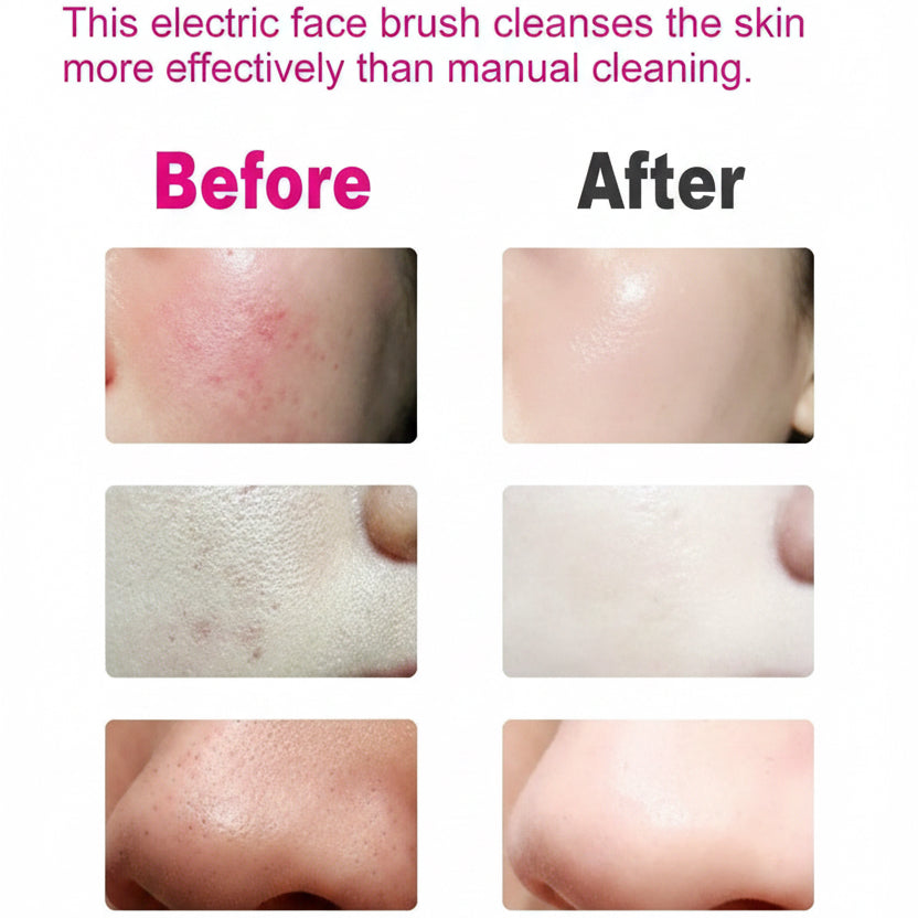 Electric face brush with before and after skin comparison on a white background