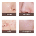 Ultrasonic Facial Cleanser