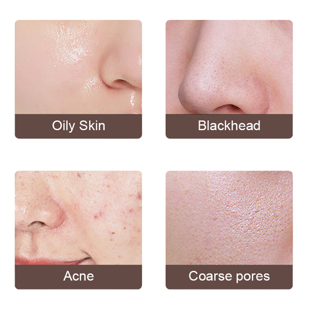 Ultrasonic Facial Cleanser